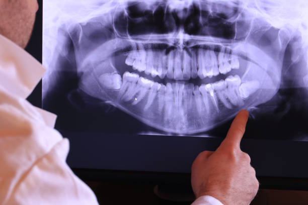 Best Mobile Emergency Dentist in Lake In The Hls, IL