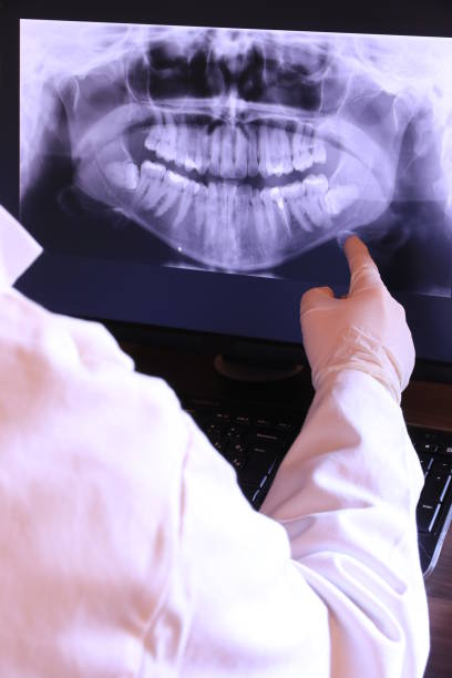 Best Emergency Root Canal Treatment in Lake In The Hls, IL