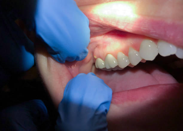 Best Emergency Dental Services for Seniors in Lake In The Hls, IL