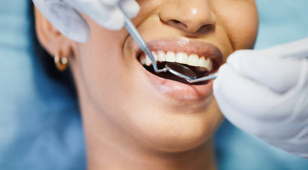 Best Emergency Dentist for Lost Fillings or Crowns in Lake In The Hls, IL