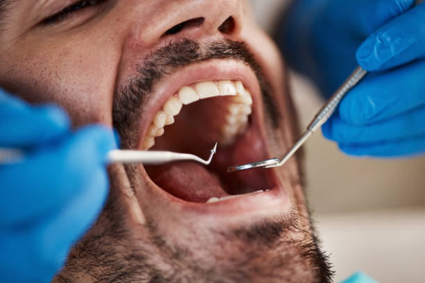Best Emergency Dental Extractions in Lake In The Hls, IL