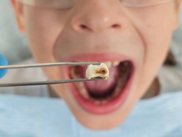 Best Weekend Emergency Dentist in Lake In The Hls, IL